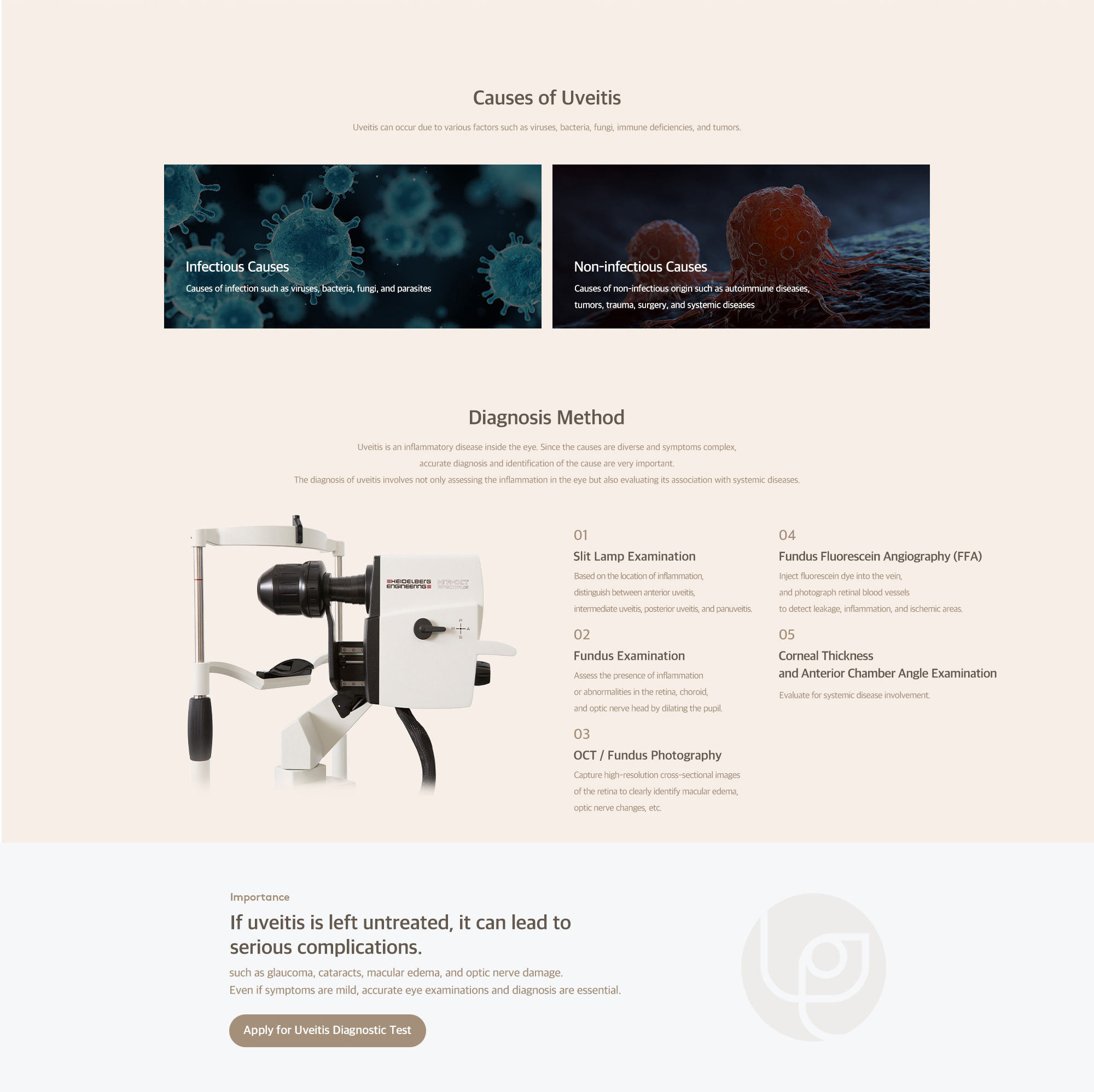 Uveitis