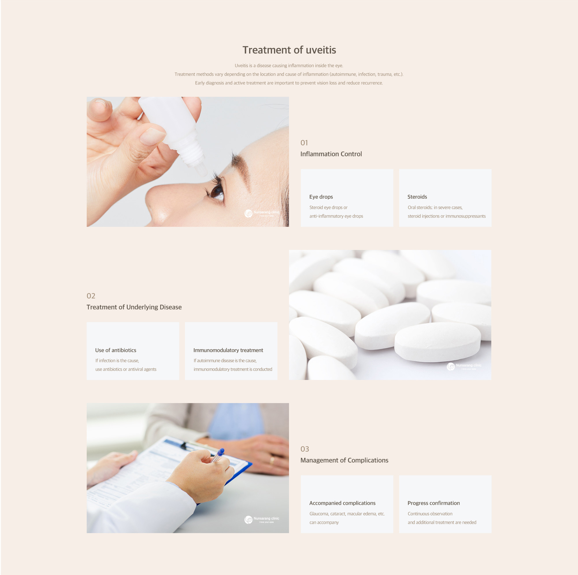 Uveitis