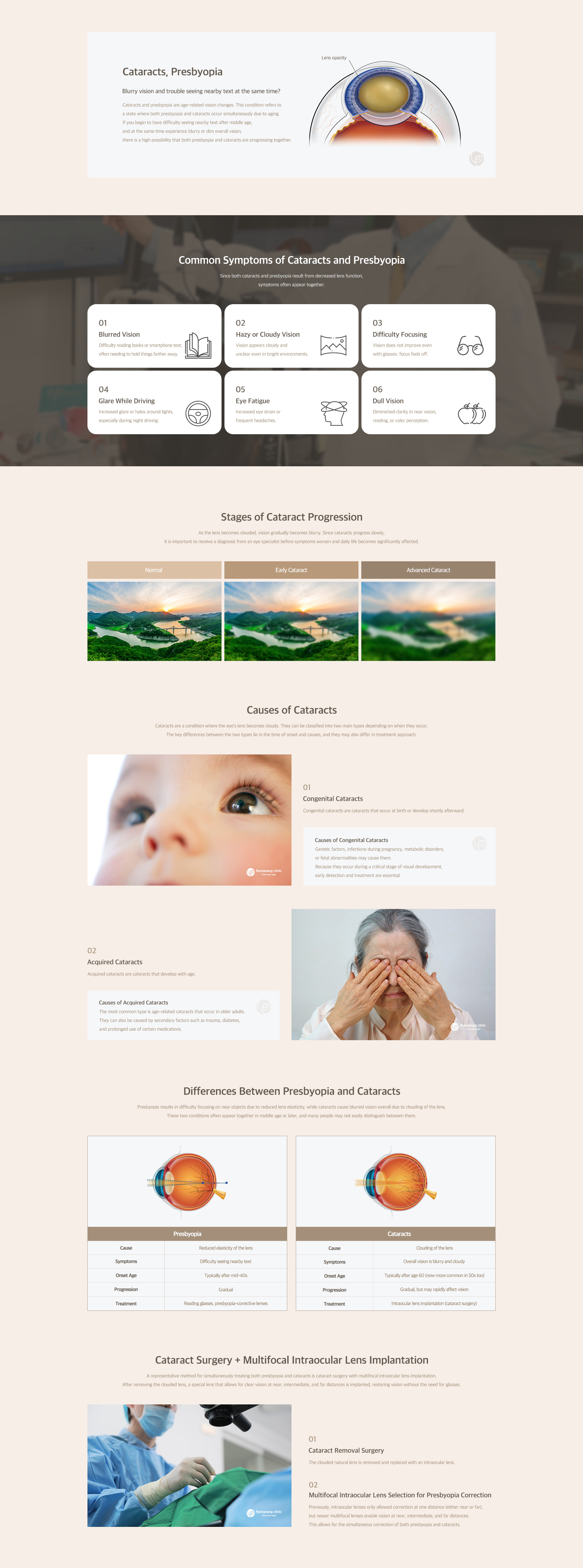 Cataracts·Presbyopia